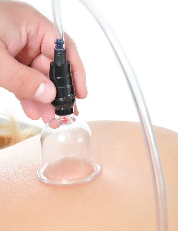 FETISH FANTASY SERIES - SET DI VENTOSE DA 6 PEZZI